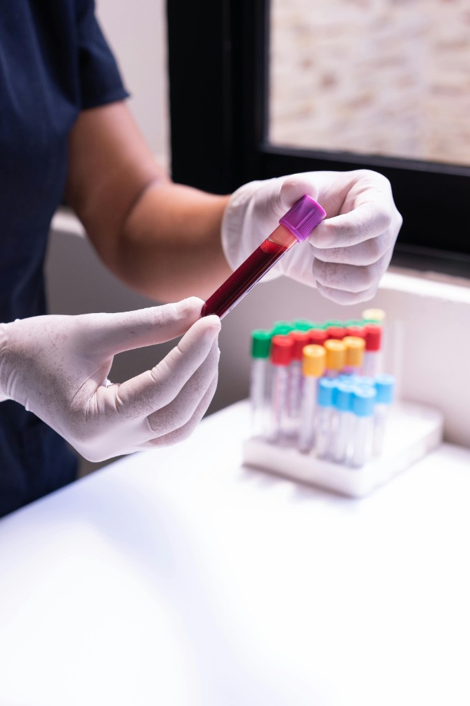 Clinician handling a blood sample for diagnostics testing